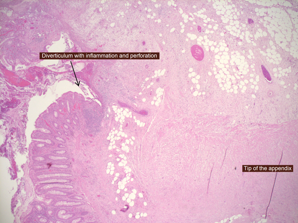 appendix histology